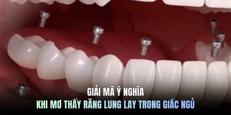 Giải mã ý nghĩa khi mơ thấy răng lung lay trong giấc ngủ